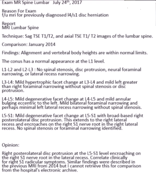 What I've Learned From My Experience Dealing with Facet Joint ...